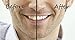 Teeth Whitening Gel with Tray - Instantly Whiter Brighter Teeth - Best Whitener Available - Makes Every Tooth as White as Possible