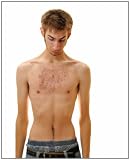 Misunderstanding Acne: Tips and Natural Cures For Acne Conditions