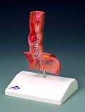 Diseases of the Esophagus Model-K18