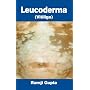 Leucoderma: Vitiligo