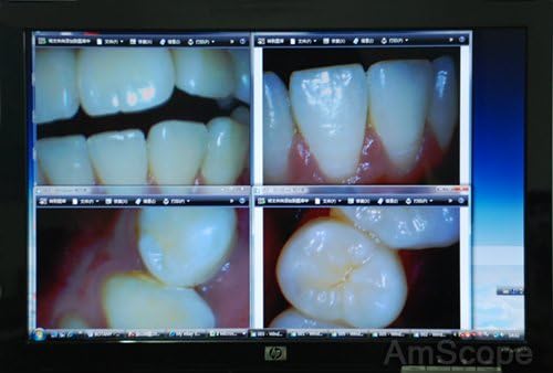 Dentist Dental Intraoral Camera 3.8mp Usb Connection