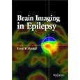 Brain Imaging in Epilepsy by David D. Maudgil