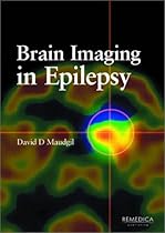 Brain Imaging in Epilepsy: Insights and Applications