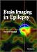Brain Imaging in Epilepsy