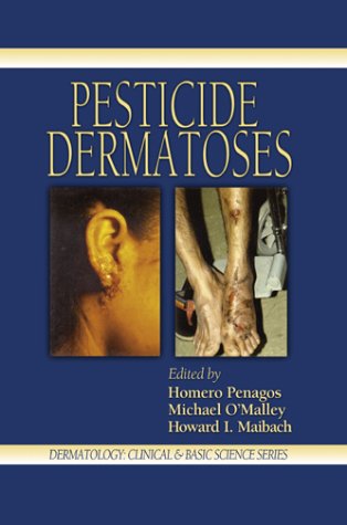 Dermatitis