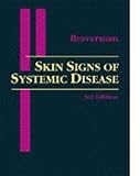 Skin Signs of Systemic Disease