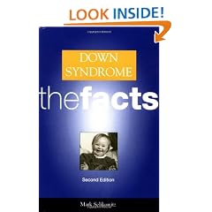 Down Syndrome: The Facts