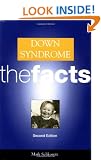 Down Syndrome: The Facts