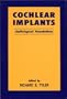 Cochlear Implants: Audiological Foundations
