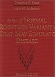 Atlas of Normal Roentgen Variants That May Simulate Disease