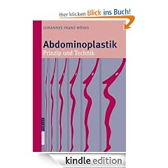 Abdominoplastik: Prinzip und Technik