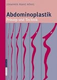 Abdominoplastik: Prinzip und Technik