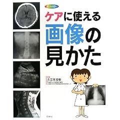 ケアに使える画像の見かた―X線写真・CT画像・エコー像・MRI