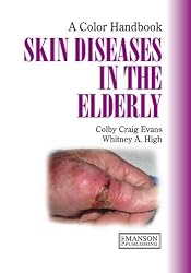 Skin Diseases in the Elderly (Colour Handbook)