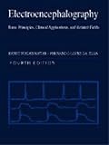 Electroencephalography : basic principles, clinical applications and related fields