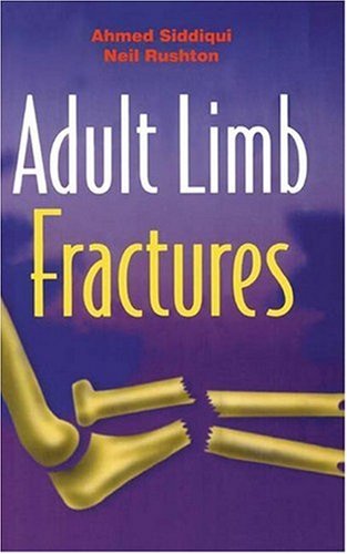Adult Limb Fractures