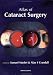 An Atlas of Cataract Surgery