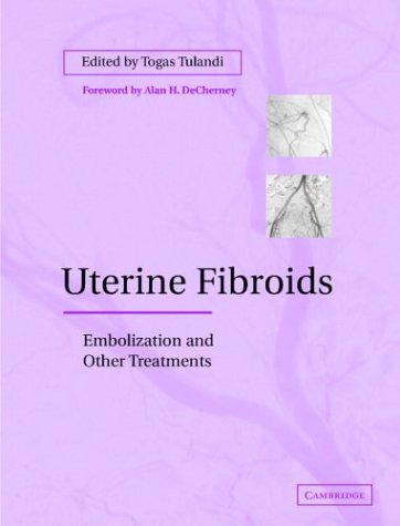 Uterine-Cancer