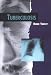 Tuberculosis (Twenty-First Century Medical Library)