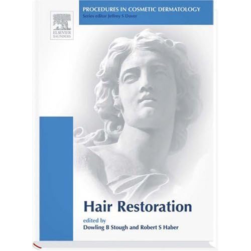 hair loss cosmetic solutions 