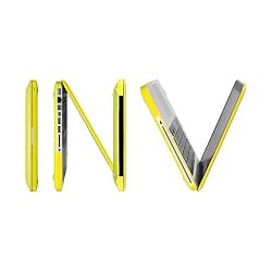 INV ® macbook X-slim case , AUREOLA / satin - WONDER begins series - for Apple Macbook Pro 13.3 inch WITHOUT retina (A1278 / with or without Thunderbolt), color- rubberized glossy yellow
