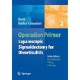 Laparoscopic Sigmoidectomy for Diverticulitis (Operation Primers)
