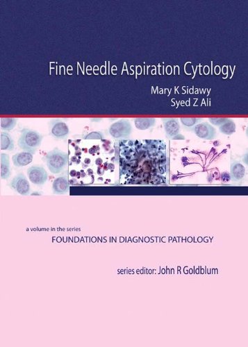 Fine Needle Aspiration Cytology: A Volume in Foundations in Diagnostic Pathology On Sale