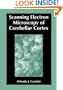 Scanning Electron Microscopy of Cerebellar Cortex
