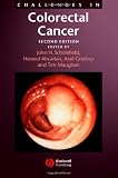 colon cancer symptoms