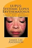 LUPUS:  Systemic Lupus Erythematosus: Symptoms. Types. Causes. Diet.  Diagnosis. Treatments. Research.