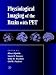 Physiological Imaging of the Brain with PET
