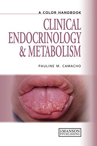 Clinical Endocrinology and Metabolism (Medical Color Handbook Series)