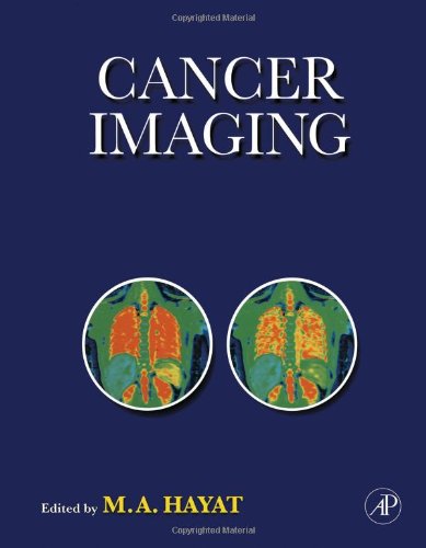 Cancer Imaging: Lung and Breast Carcinomas