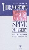 Video Atlas of Thoracoscopic Surgery [VHS]