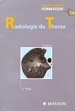 Radiologie du thorax