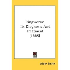 Ringworm: Its Diagnosis And Treatment (1885)