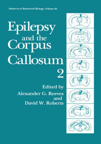 Epilepsy