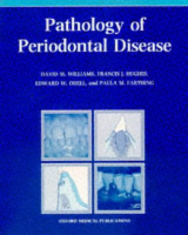 Periodontal Diseases
