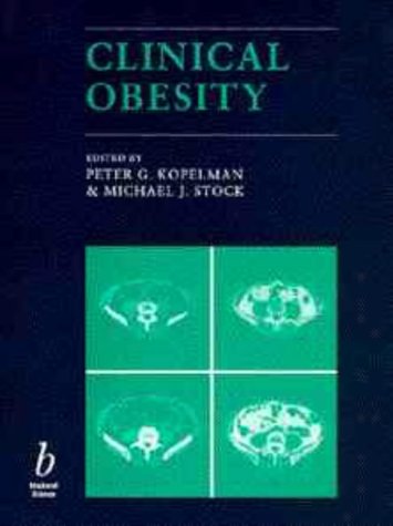 City Travel Guides Discounted  Books : Clinical Obesity
