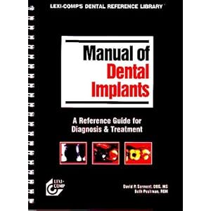 Lexi-Comp's Manual of Dental Implants (Lexi-Comp's Dental Reference Library) by David Sarment and Beth Peshman
