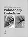 Pulmonary Embolism: Epidemiology, Diagnosis and Treatment