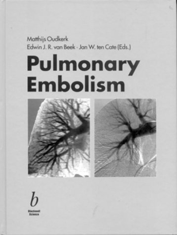 Pulmonary-Embolism
