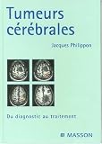 Tumeurs c�r�brales