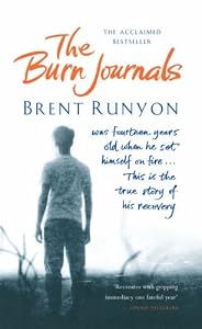 Cover of "The Burn Journals" Cover of "The Burn Journals"