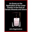 An Essay on the Application of the Lunar Caustic (1826)