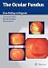 The Ocular Fundus: From Findings to Diagnosis con Libri relativi al nominativo: 41CZWLXwdlL._SL75_