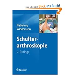 Schulterarthroskopie