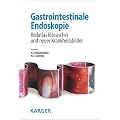 Gastrointestinale Endoskopie: Bildatlas klassischer und neuer Krankheitsbilder