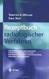 Rezeptbuch radiologischer Verfahren - Torsten B. M&ouml;ller, Emil Reif, Markus Bach, Heribert Becker, Christoph Buntru
