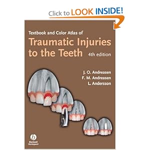 Click here to buy Textbook and Color Atlas of Traumatic Injuries to the Teeth by Jens Andreasen, Frances Andreasen, and Lars Andersson.